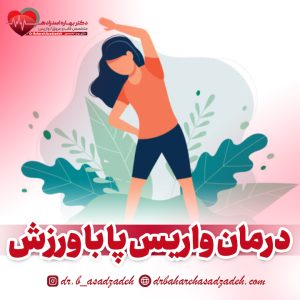 درمان واریس پا با ورزش