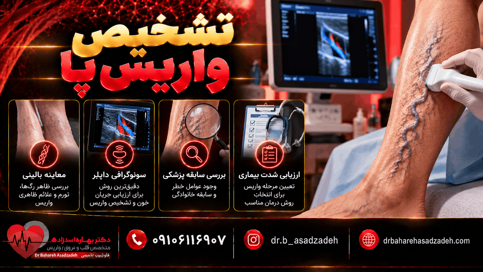 تشخیص واریس پا