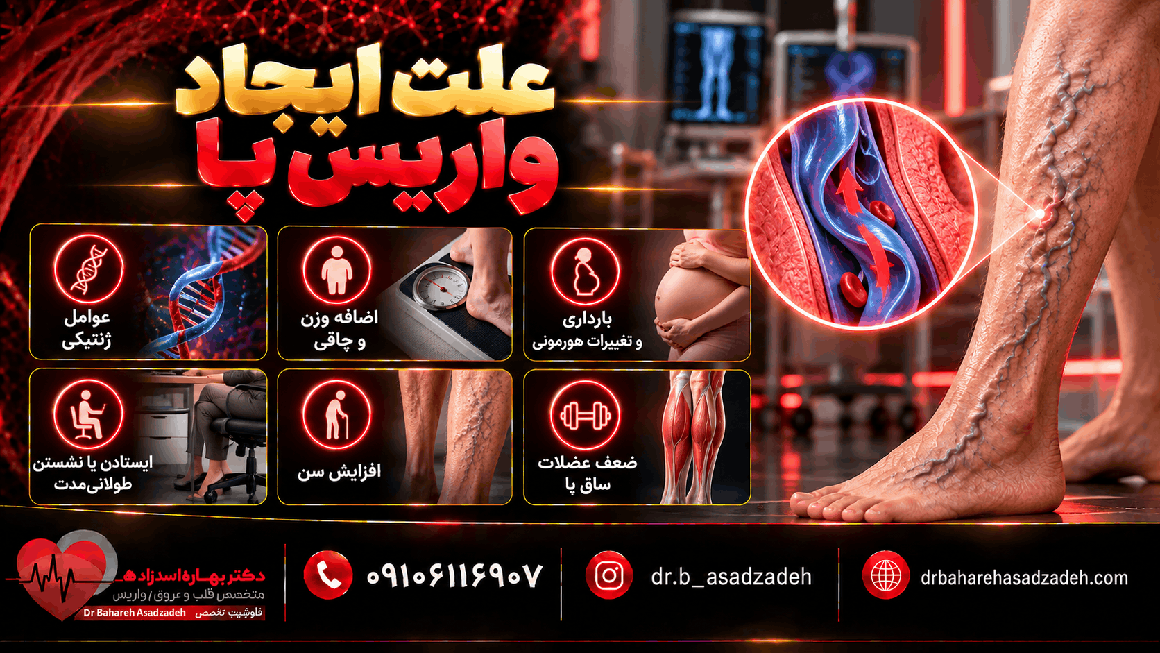 علت ایجاد واریس پا