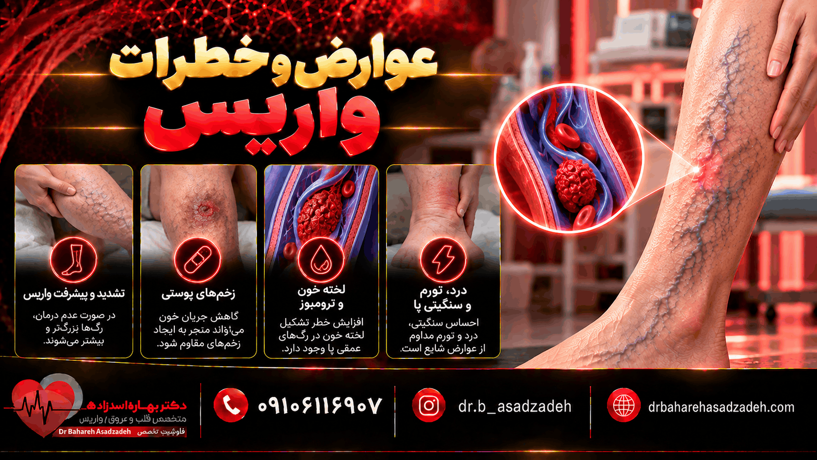 عوارض و خطرات واریس