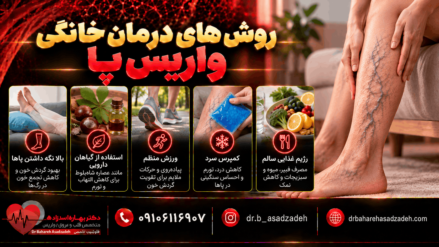 روش های درمان خانگی واریس پا