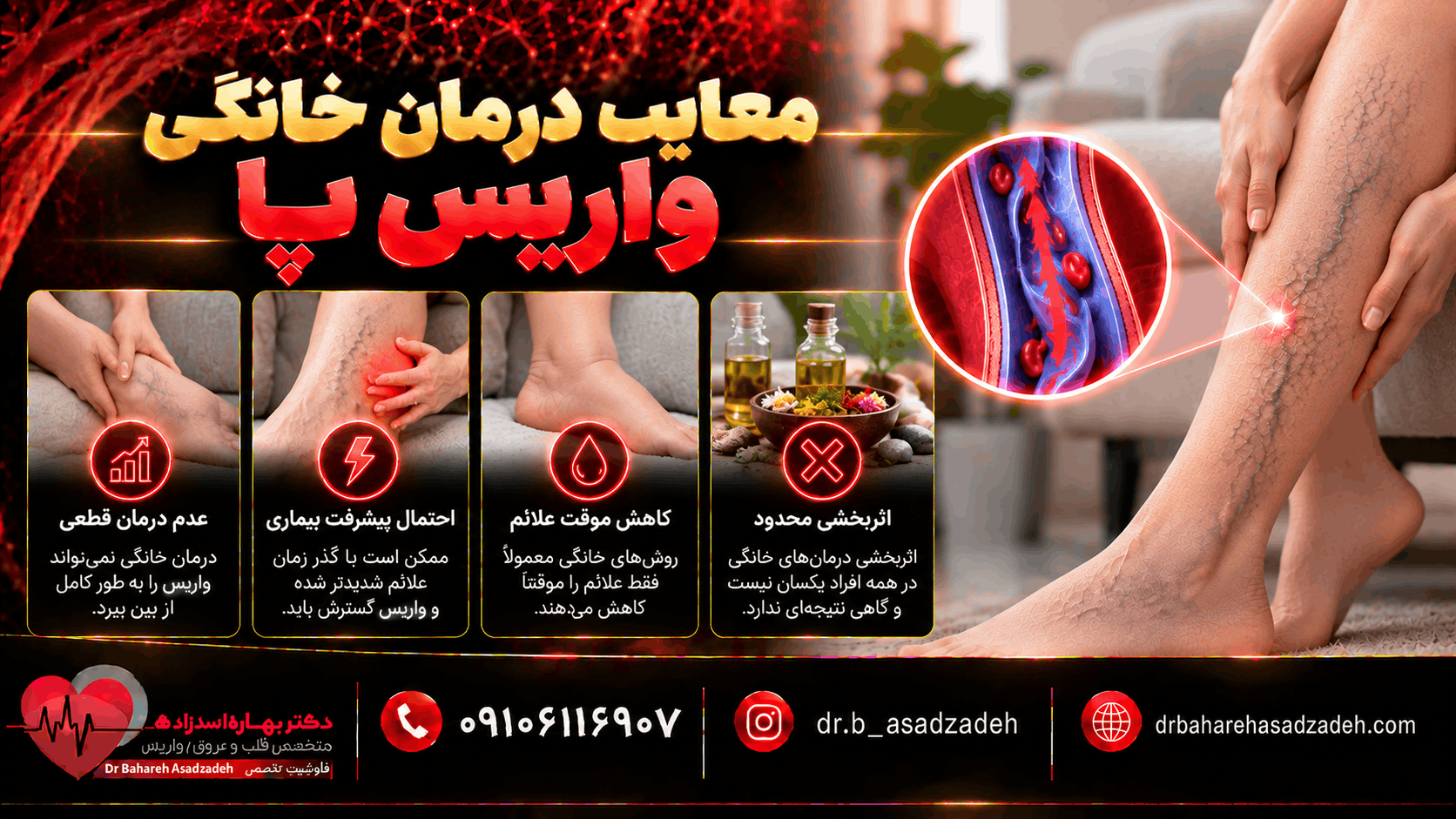 معایب درمان خانگی واریس پا