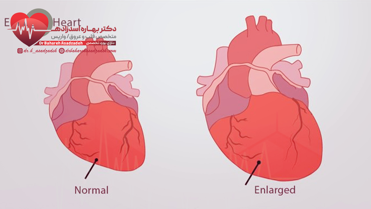 دلایل بزرگ شدن قلب