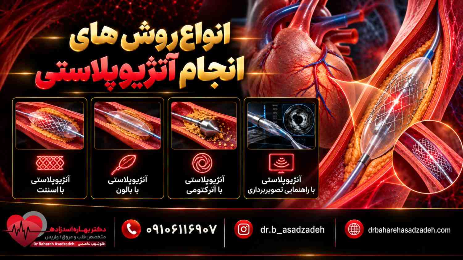 انواع روش های انجام آنژیوپلاستی