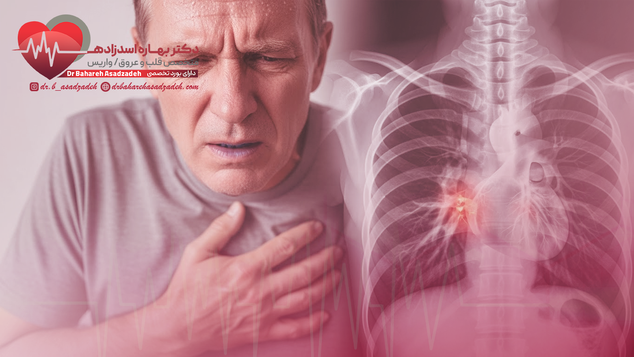آنژین (Angina)