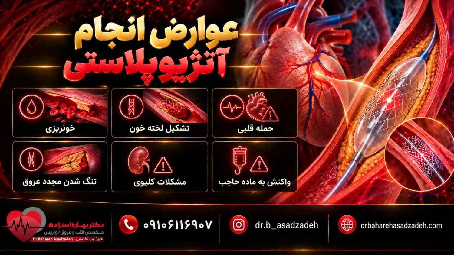 عوارض انجام آنژیوپلاستی