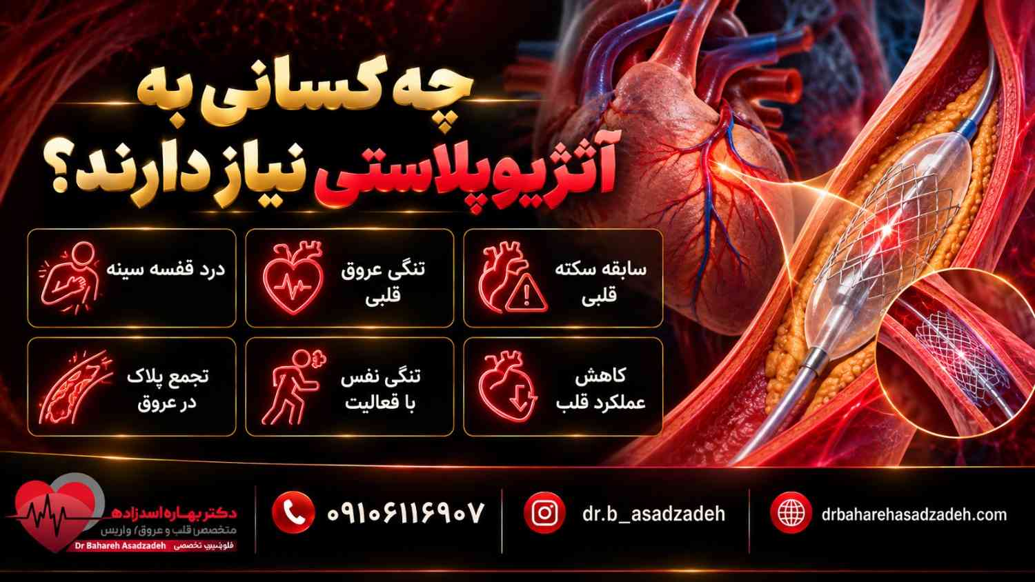 چه کسانی به آنژیوپلاستی نیاز دارند؟