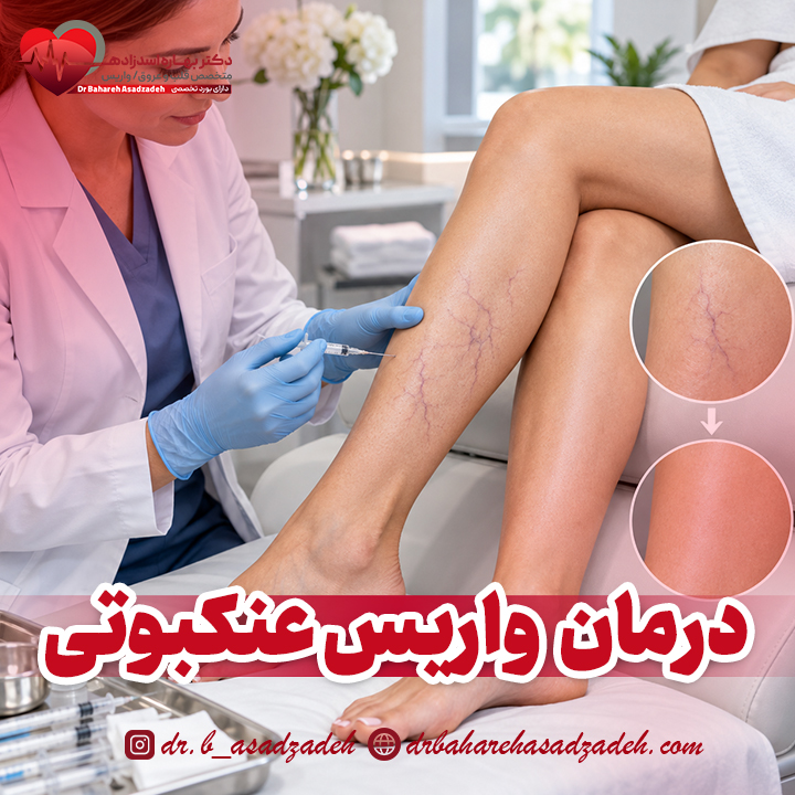 درمان رگ های واریس عنکبوتی