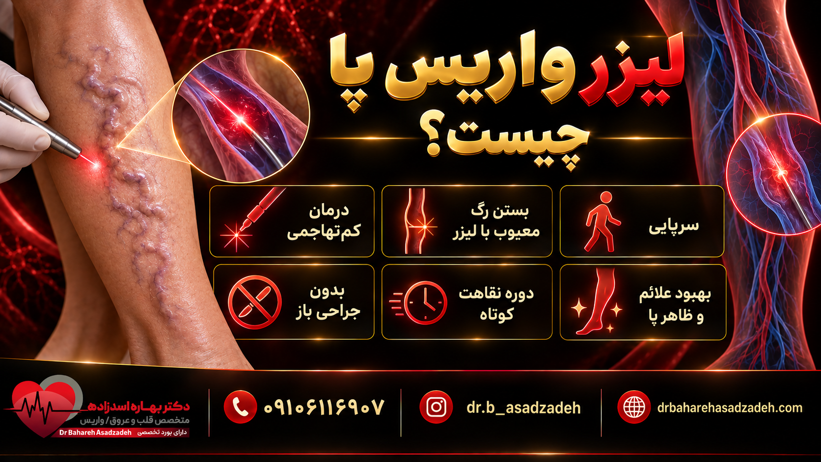 لیزر واریس پا چیست؟