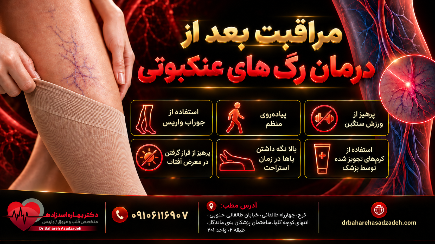 مراقبت بعد از درمان رگ های عنکبوتی
