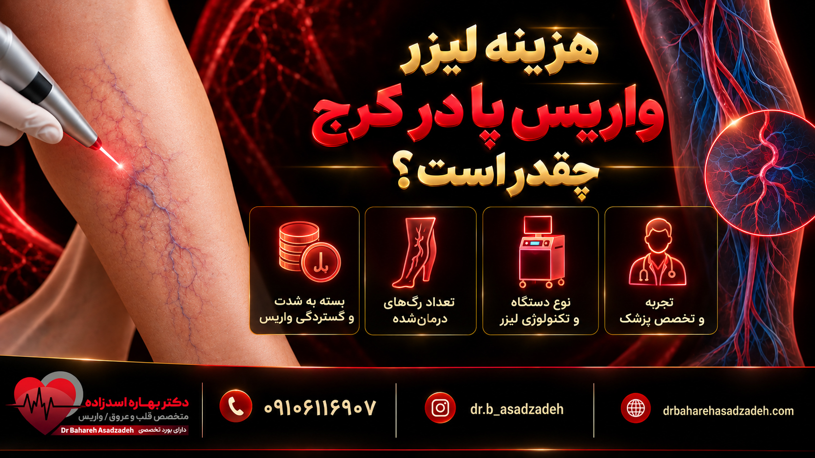 هزینه لیزر واریس پا در کرج چقدر است؟